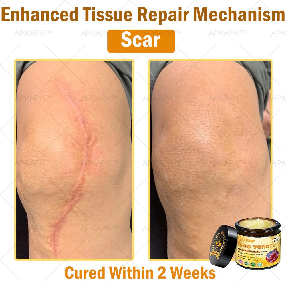 Professional Bee Venom Repair Cream, For All Body Parts