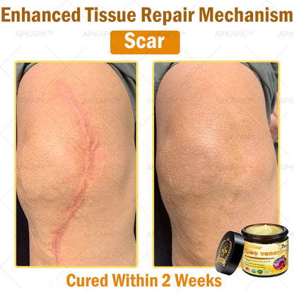 Professional Bee Venom Repair Cream, For All Body Parts