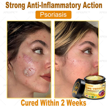 Professional Bee Venom Repair Cream, For All Body Parts